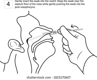 Gently insert the swab into the nostril. Keep the swab near the septum floor of the nose while gently pushing the swab into the post nasopharynx. step 4, line drawing