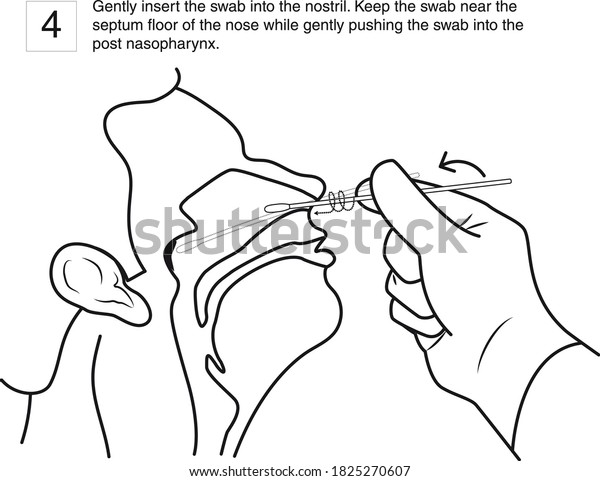 Gently insert the swab\
into the nostril. Keep the swab near the septum floor of the nose\
while gently pushing the swab into the post nasopharynx. step 4,\
line drawing