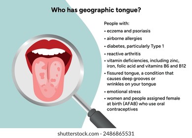 Geographic tongue, causes, medical illustration