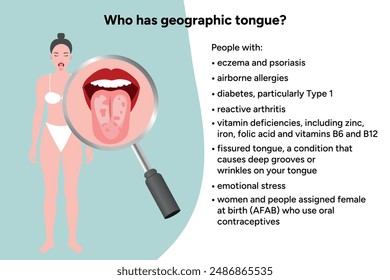 Geographic tongue, causes, medical illustration