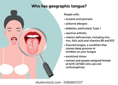 Geographic tongue, causes, medical illustration