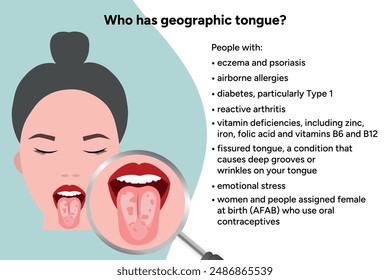 Geographic tongue, causes, medical illustration