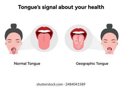 Geographic tongue problem and normal tongue with female face