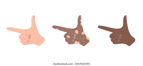 Gesture of pointing with finger isolated on white background. Hand drawn vector illustration in flat style. Human hand in white, dark and vitiligo skin. Concept of diversity, body language