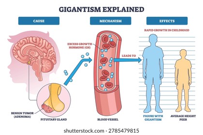 Gigantism explained overview shows pituitary tumor causing excess growth hormone in blood and rapid height increase, brain, blood vessel, tall child compared to peer. Outline diagram