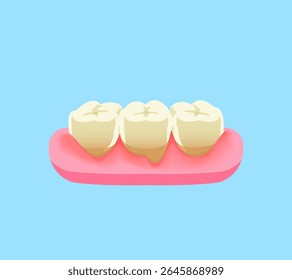 Recessão gengival pertencente às gengivas e tecidos circundantes ilustração design vetorial. Conceito de tratamento dentário.