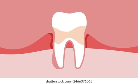 Emblema de gingivitis, ilustración de color plano