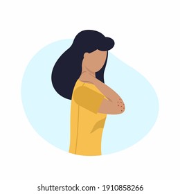 A girl with an allergic rash on her arm. Problems with the skin. Vector illustration on the topic of dermatology