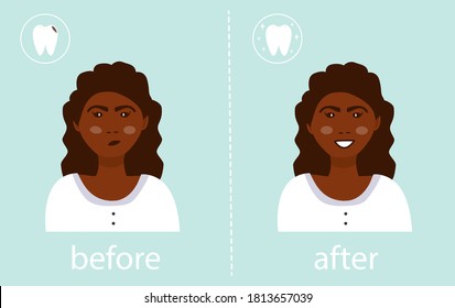 Niña antes y después del tratamiento de caries. Afiche de demostración. Autoconfianza, salud, gran sonrisa. Imagen motivacional. Tratamiento dental, caries. Gráficos vectoriales. Plano.