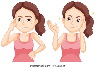 Girl before and after having pimple on her face illustration