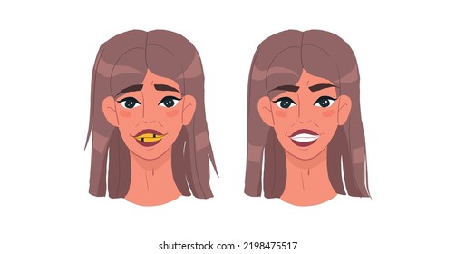 girl before and after, with an ugly smile and even white teeth. Clean teeth with mouthwash in flat design. Smiling teeth cartoon dental care. Oral healthcare with mouthwash for plaque prevention and f