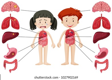 Girl and boy with different healthy and unhealthy body illustration