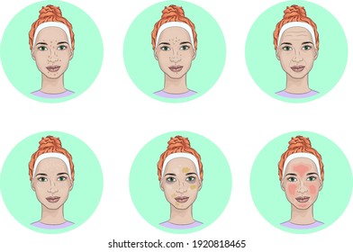 Girl face with skin problems. Common face skin problems