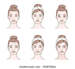 
Girl has a problems with her skin. Different facial troubles. Line style vector illustration.