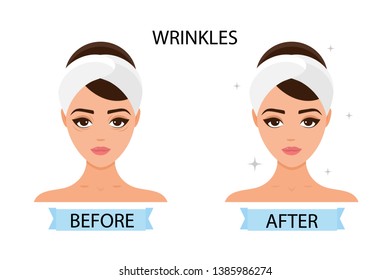 Girl has wrinkles on her face. Before and after. Concept of skincare, pure and healthy skin. Vector illustration.