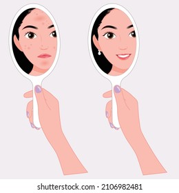 Girl looking into a mirror, before and after skin care make up, nature beauty concept, facial skin problems,  Causes of disease,treatment,Types of acne,skin problems, acne,pimples, whiteheads