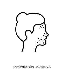 Girl with Pimples on Face Line Icon. Woman with Blackhead, Acne, Rash Linear Pictogram. Dermatologic Problem, Allergy, Inflammation Skin Outline Icon. Editable Stroke. Isolated Vector Illustration.