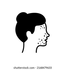 Girl With Pimples On Face Silhouette Icon. Woman With Blackhead, Acne, Rash Pictogram. Dermatologic Problem, Allergy, Inflammation Skin Black Icon. Isolated Vector Illustration.