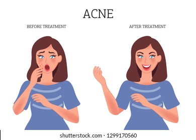 Girl with pimples on her face before treatment and after therapy. Inflammation under the skin, bacterial disease and toxins on the skin. Vector illustration of people