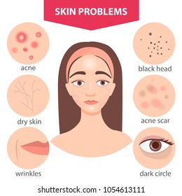 Girl with problem skin. Infographics. - Shutterstock ID 1054613111