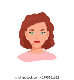 Una chica con piel problemática. Ilustración vectorial.
