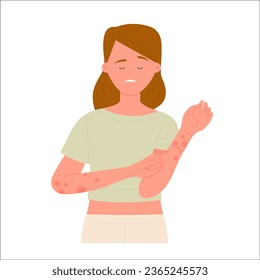 Girl scratching hands covered with red rash. Skin allergic reaction, atopic dermatitis vector flat illustration