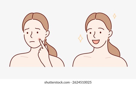 Girl with skin problem before and after. Vector illustration in cartoon korean style.