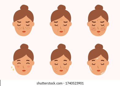 Girl Skin Problem And Skin Type