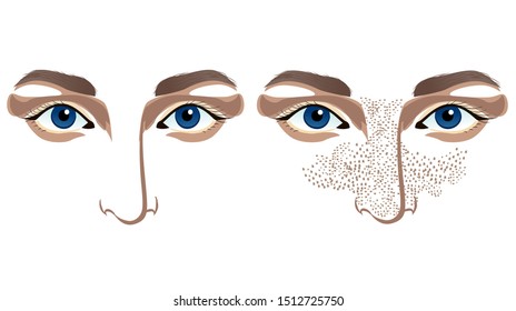 Girl with skin problems and with clean skin on the white background