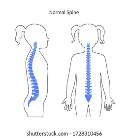 Girl Spine Vector Illustration. Backbone And Vertebral Child Column Anatomy. Scoliosis Concept And Symbol Of Spinal Surgery. Back View Isolated. Medical, Educational And Science Banner