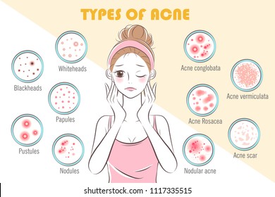 girl with types of acne on the yellow background