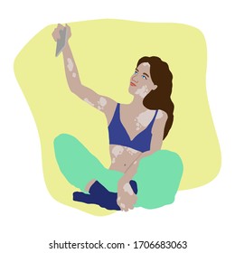Girl with vitiligo skin disease makes selfie sitting cross legged.Beautiful woman in bra and home pants flat illustration.Girl with marks on her skin vector design.