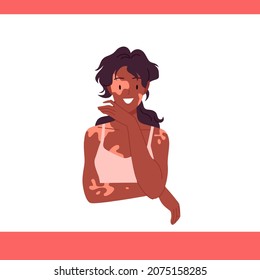 Girl with vitiligo smiling vector illustration. Cartoon young woman with different shape of depigmentation on body and face skin, happy lady standing. Health care, body positive, medical concept