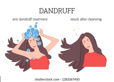 The girl washes her head with a therapeutic shampoo for dandruff and the result of treatment after. Dandruff problem on the head. Vector illustration of skin disease