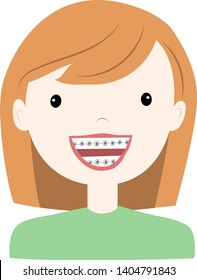 Girl wearing braces  tooth system. Vector illustration.