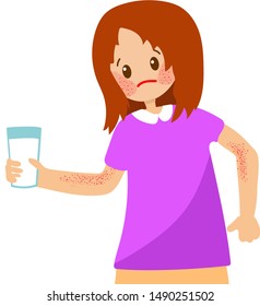 Girl who developed dermatitis in milk allergy. Allergy to cow's milk protein. Girl with skin irritation
