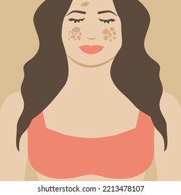 Chica o mujer con Melasma. Diseño de ilustraciones de puntos de pigmentación 