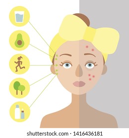 Girl with a yellow bow on her head. One part of her skin is healthy, the other is problematic. On the left circles, which indicate useful factors for the skin.Flat vector