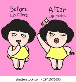 Girl's Face Before And After Lip Filler Injections Concept Card Character illustration