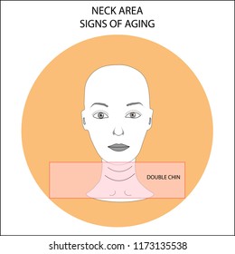 Girl's face scheme demonstrating wrinkles on the neck