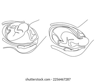 Geburt.Vaginale Geburt und c-Sektion Symbole, Emblem, Poster-Design-Vorlage Linie Kunst Vektorgrafik, Symbole, Vektorgrafik.Fetale Position innerhalb der Gebärmutter Liner Schwarz-Weiß-Zeichnung