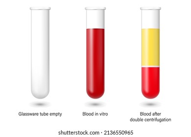 676 Centrifuge blood Stock Illustrations, Images & Vectors | Shutterstock