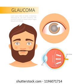 Glaucoma infographics. A young man with glaucoma. The structure of the eye.

