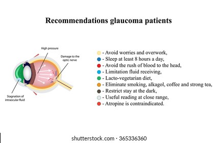 Glaucoma. Recommendations glaucoma patients. The structure of the eye. Glaucoma Day. Infographics. Vector illustration on isolated background.