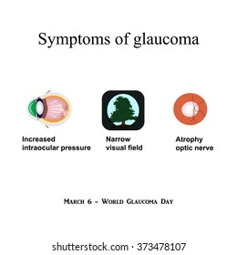 Glaucoma. Symptoms of glaucoma. Atrophy of the optic nerve. Field of view at glaucoma. Infographics. Vector illustration on isolated background.