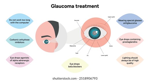 Glaucoma treatment medical information and anatomy ophthalmologist