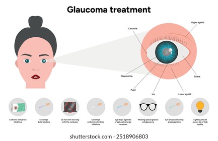 Tratamento de glaucoma informações médicas e anatomia oftalmologista