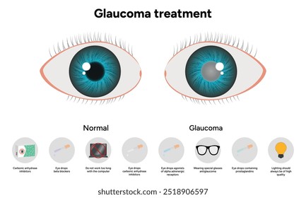 Tratamento de glaucoma informação médica oftalmologista