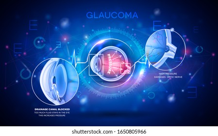 Trastorno de la visión de glaucoma fondo científico azul abstracto, anatomía detallada ilustración digital futurista.