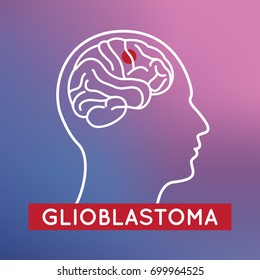 Glioblastoma Vector Icon Illustration, Brain Vector